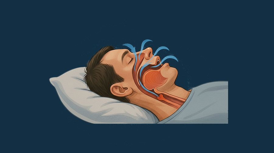 Vertigo (Baş Dönmesi)